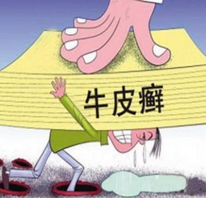 苏金单抗的副作用有哪些？