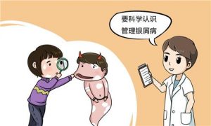银屑病到底是什么病？